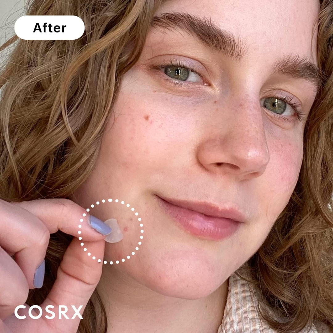 Cosrx Acne Pimple Master Patch